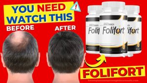 Folifort Reviews Folifort Hair Growth Reviews Folifort Tablet